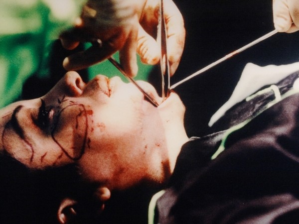 Orlan, The second mouth, 7th surgery-performance titled Omnipresence, New York, 1993 | © Orlan by Siae 2016 Courtesy Merano Arte “Gestures - Women in action”