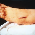 Andres Serrano, The Morgue (Rat Poison Suicide II), 1992, cibachrome, cm 91x110