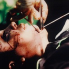Orlan, The second mouth, 7th surgery-performance titled Omnipresence, New York, 1993 | © Orlan by Siae 2016 Courtesy Merano Arte “Gestures - Women in action”