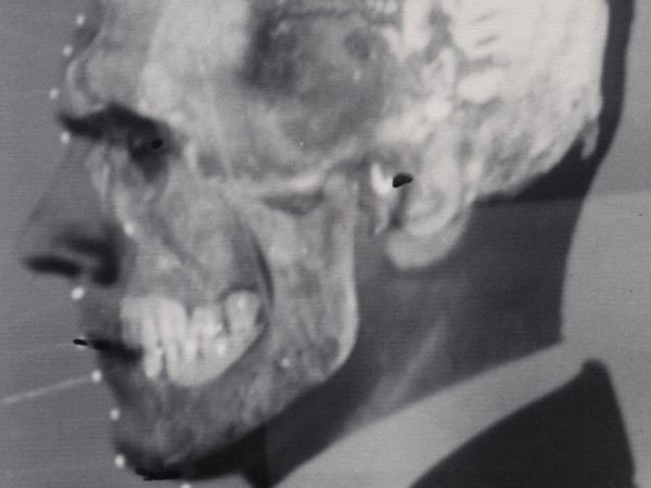 Montaggio video prodotto usando fotografie di Mengele e del suo cranio nella dimostrazione per sovrapposizione di Richard Helmer, Medical-Legal Institute Labs, San Paolo, Brasile, giugno 1985 | ©Richard Helmer, courtesy Maja Helmer, 1985