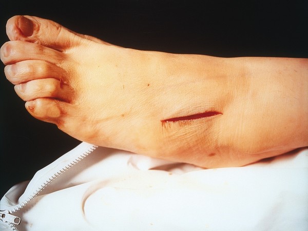 Andres Serrano, The Morgue (Rat Poison Suicide II), 1992, cibachrome, cm 91x110